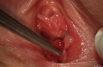 d0bfd0bed0bbd0b8d0bfd18b d0b6d0b5d0bdd181d0bad0b8d185 d0bfd0bed0bbd0bed0b2d18bd185 d0bed180d0b3d0b0d0bdd0bed0b2