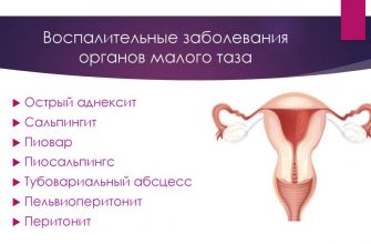 Воспалительные гинекологические заболевания 38 d0b2d0bed181d0bfd0b0d0bbd0b8d182d0b5d0bbd18cd0bdd18bd0b5 d0b3d0b8d0bdd0b5d0bad0bed0bbd0bed0b3d0b8d187d0b5d181d0bad0b8d0b5 d0b7d0b0d0b1